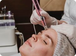 Microneedling